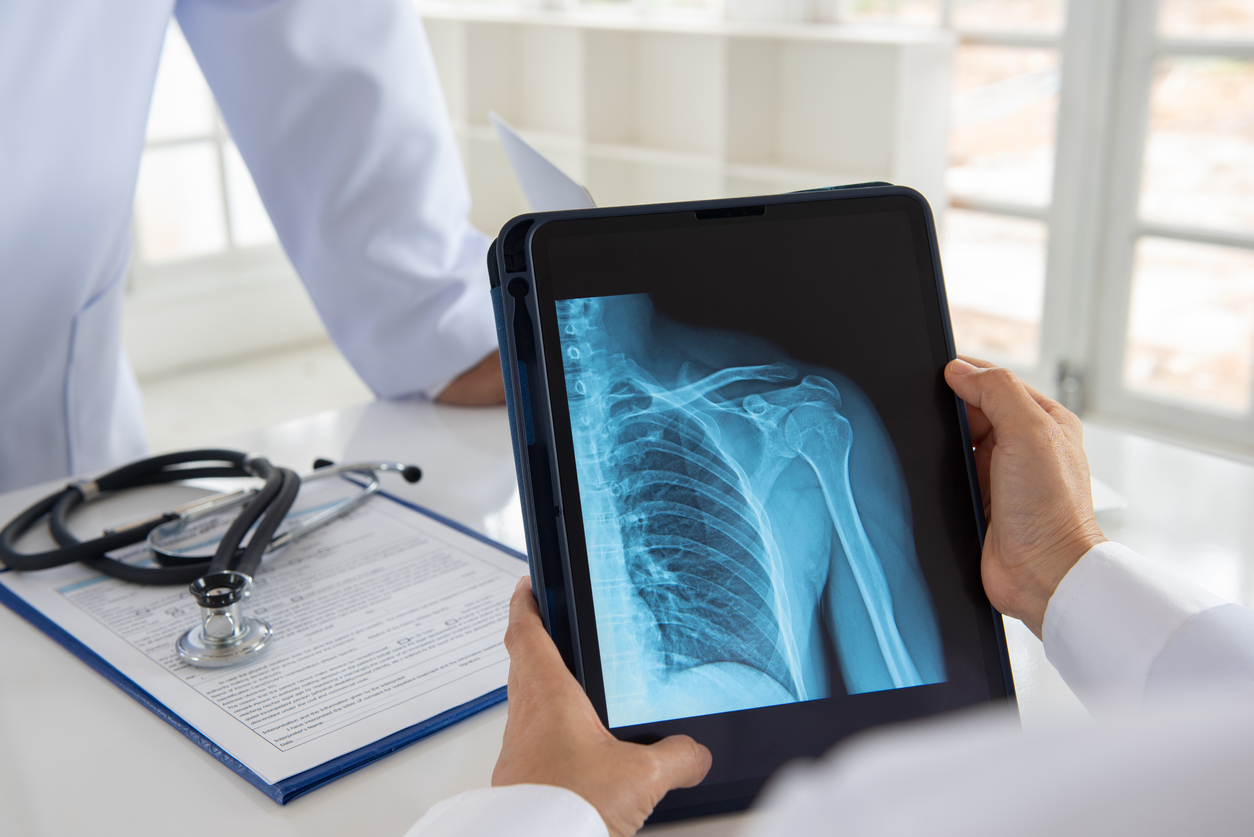 xray causes of shoulder pain