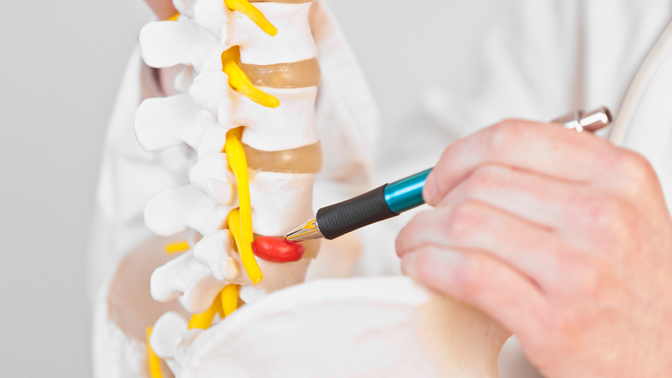 lumbar radiculopathy
