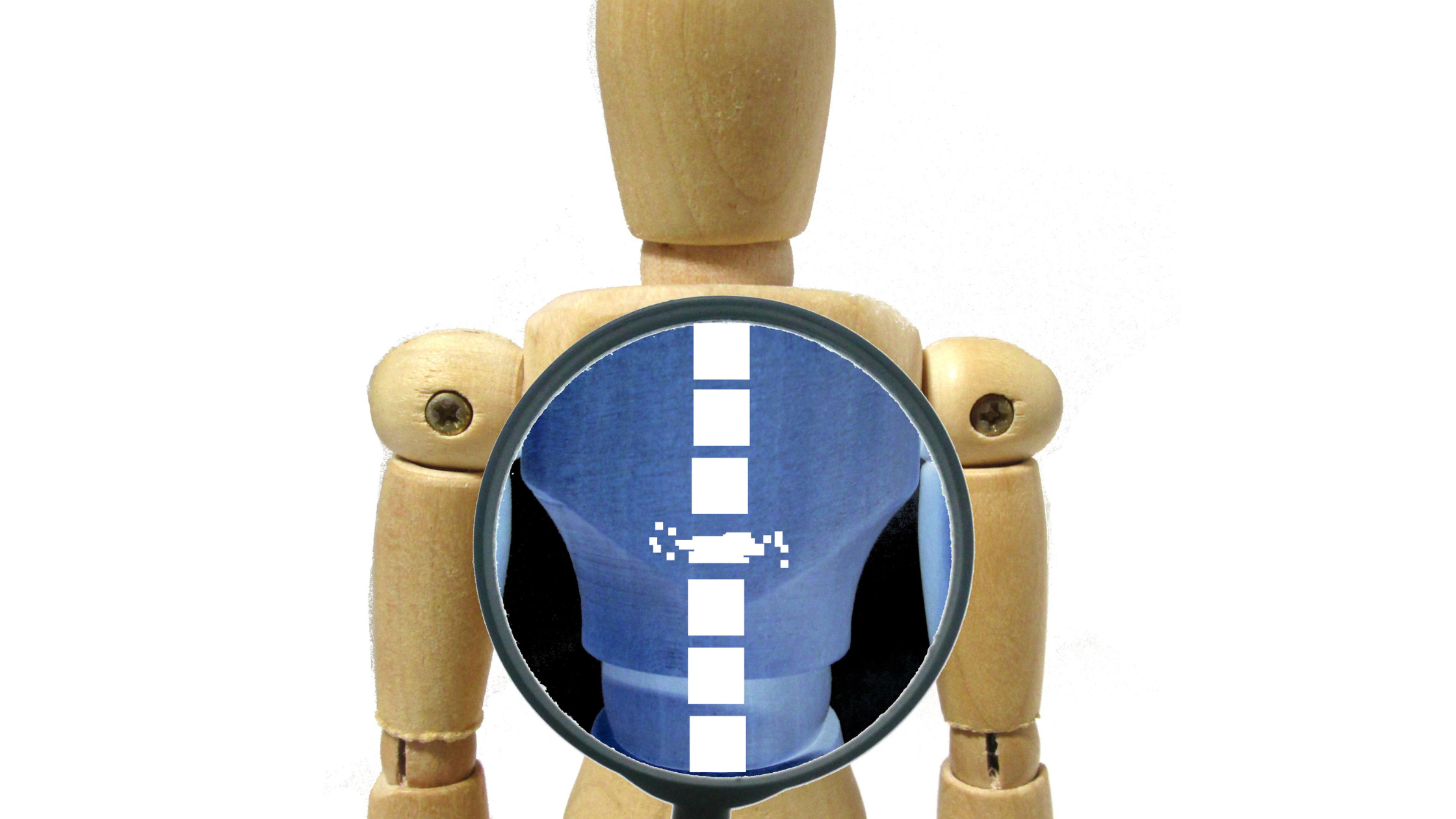 graphic model with compression fractures