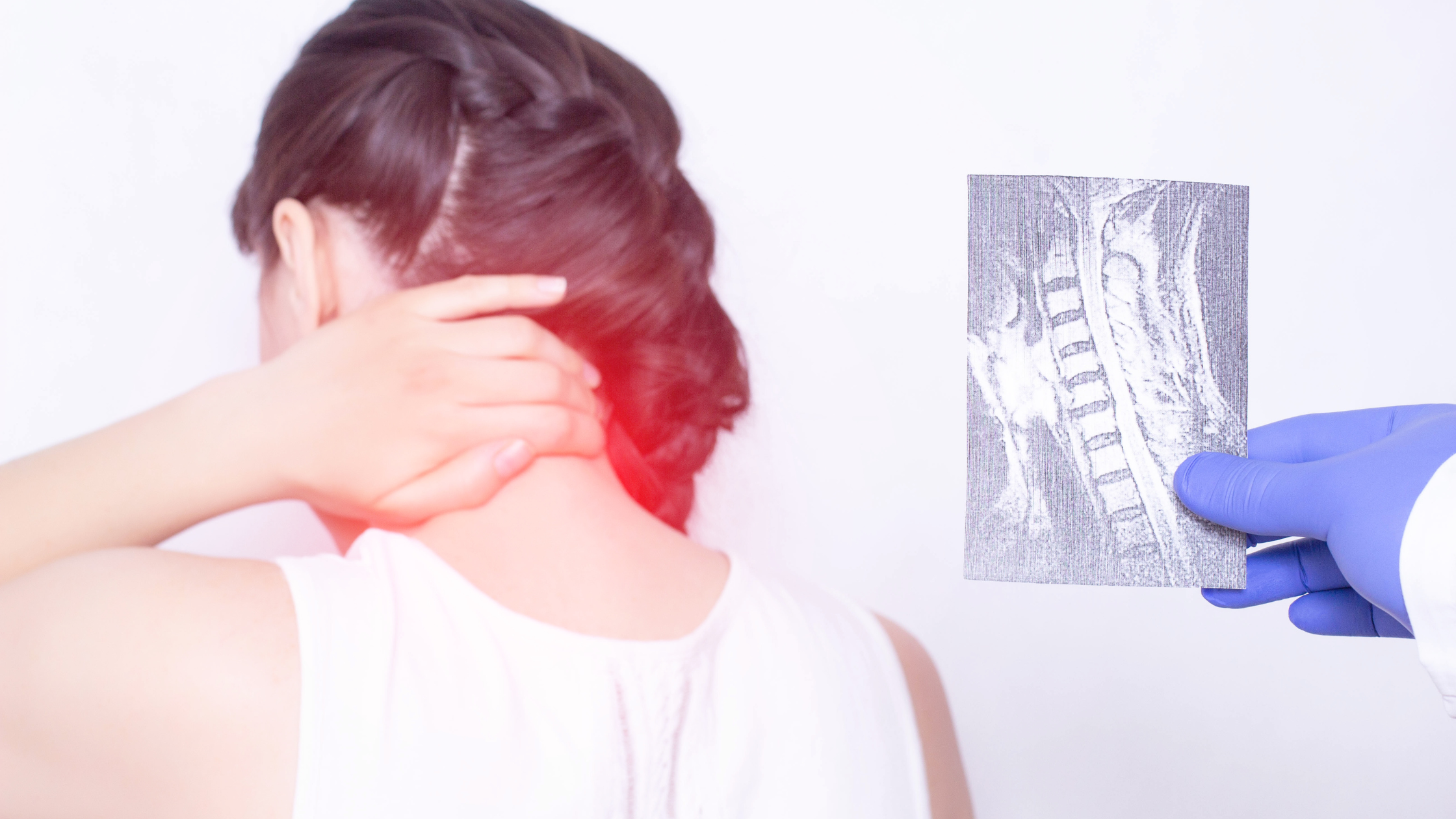 occipital neuralgia treated with implanted nerve stimulators