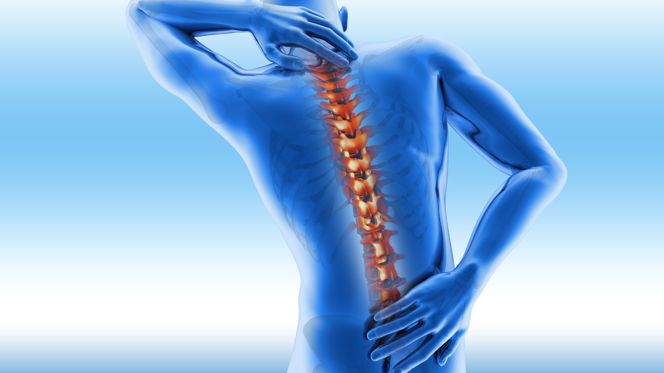 who can benefit from epidural steroid injections