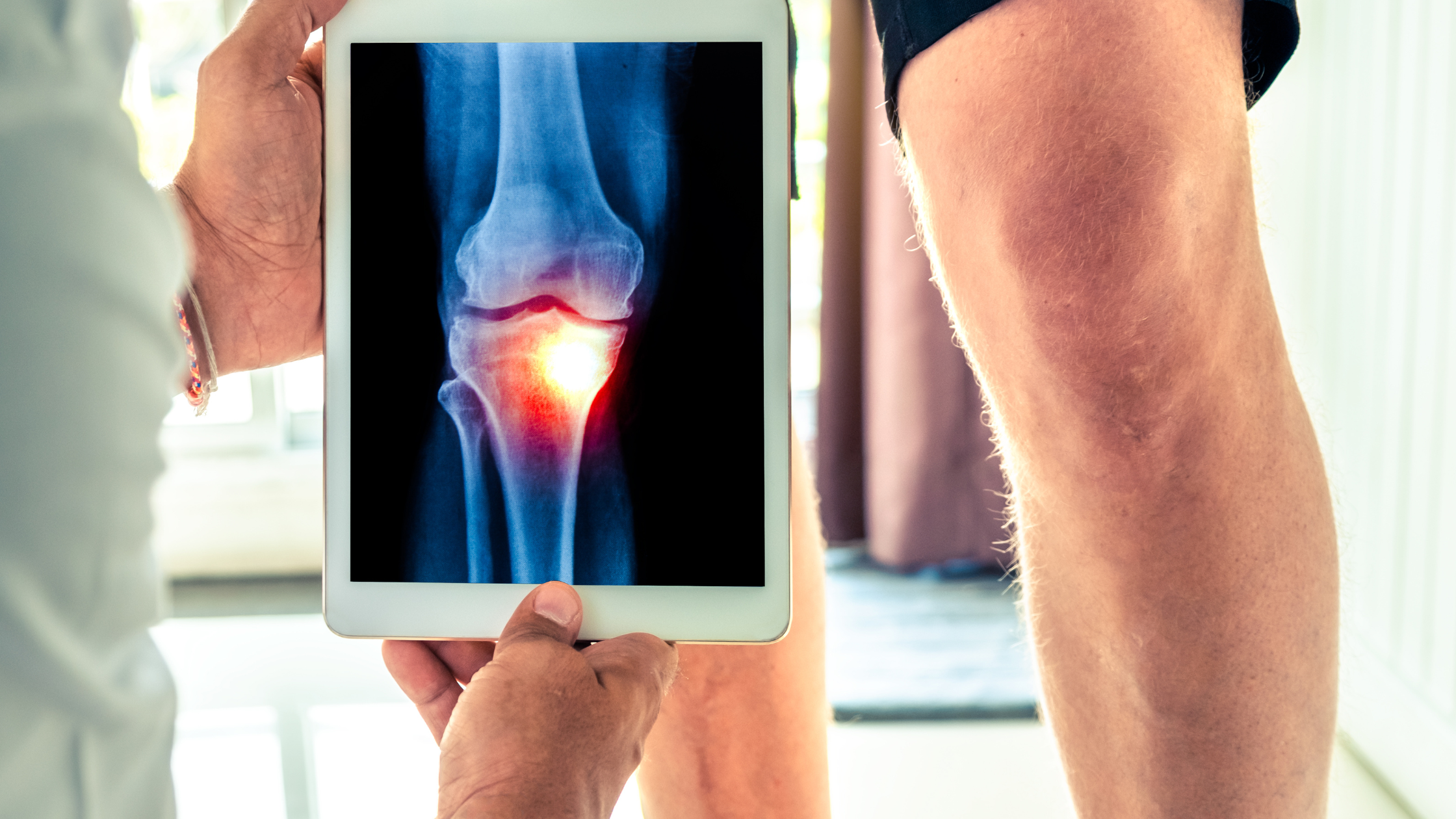 managing knee pain after surgery