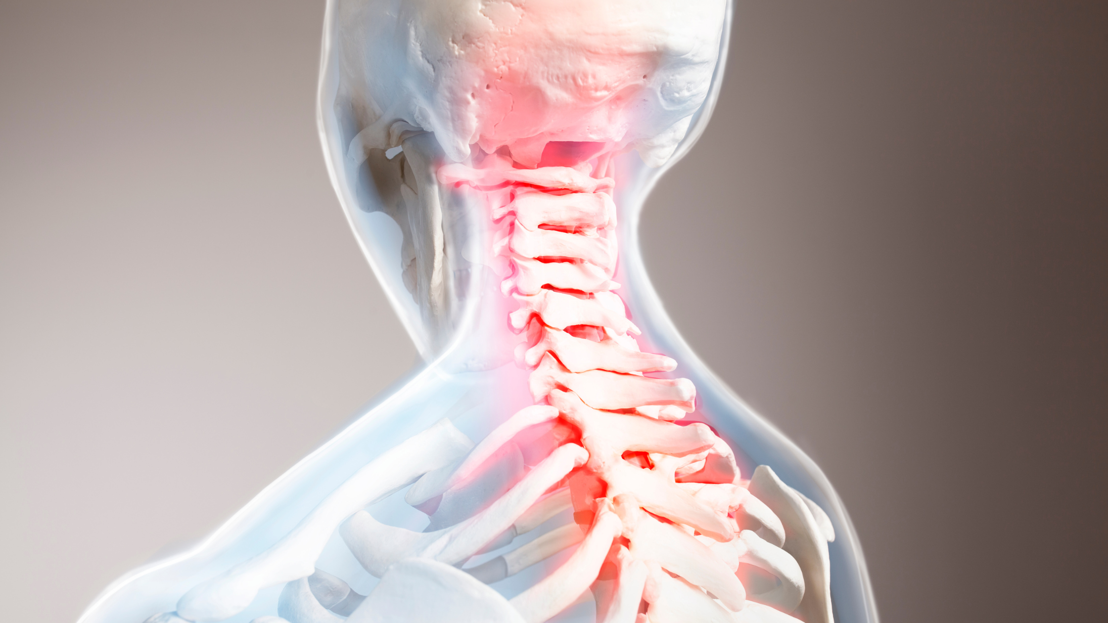 cervical spondylosis