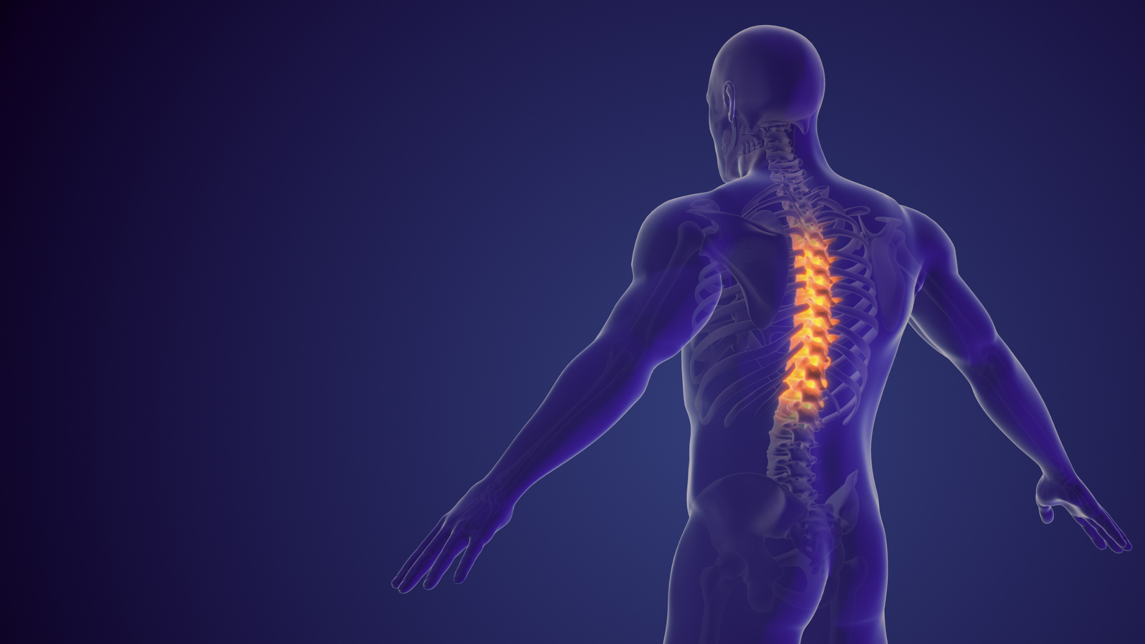 spinal compression fractures