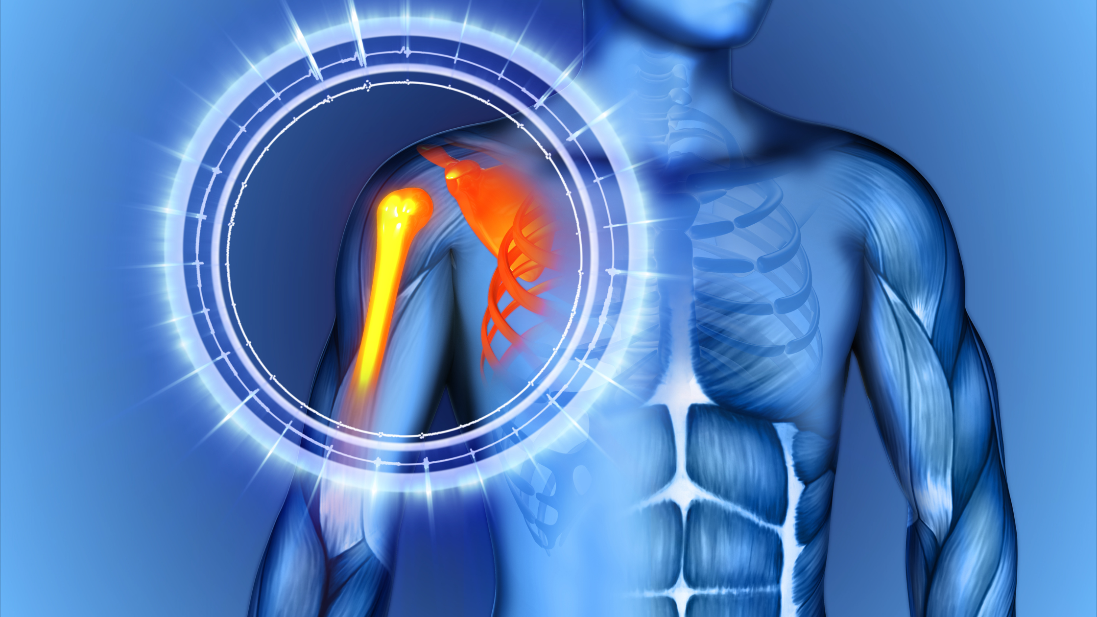 shoulder instability